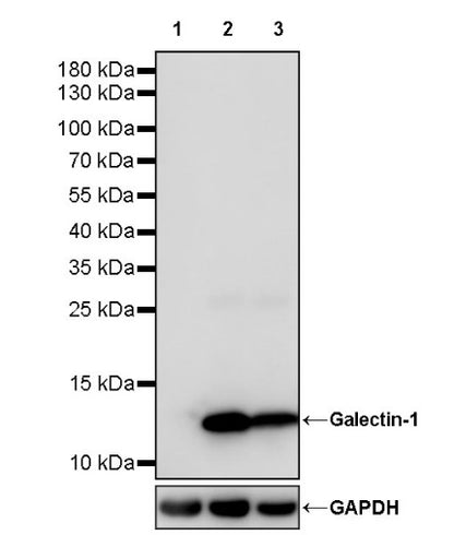Galectin-1 Recombinant Rabbit mAb (S-1221-32）