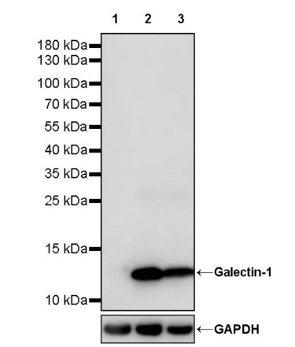 Galectin-1 Recombinant Rabbit mAb (S-1221-32）