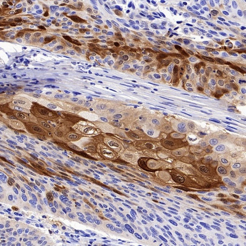 SERPINB3 Recombinant Rabbit mAb (S-4587)