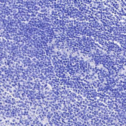 S-RMab® E-Cadherin Recombinant Rabbit mAb (SDT-438-5)