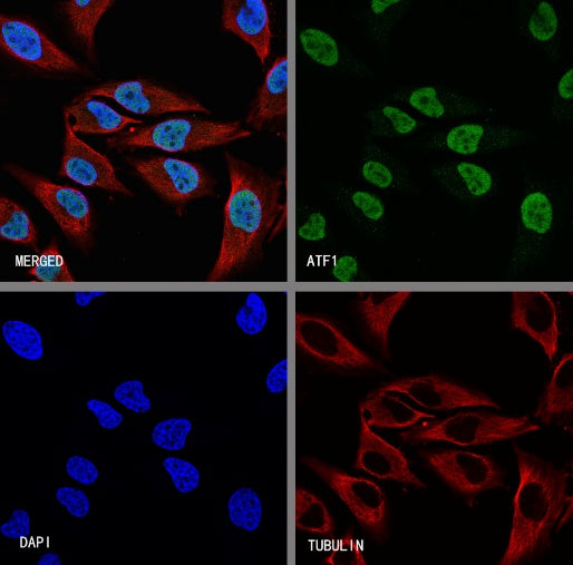 ATF1 Recombinant Rabbit mAb (S-2883-124)