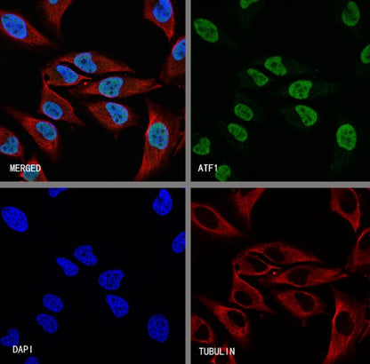 ATF1 Recombinant Rabbit mAb (S-2883-124)