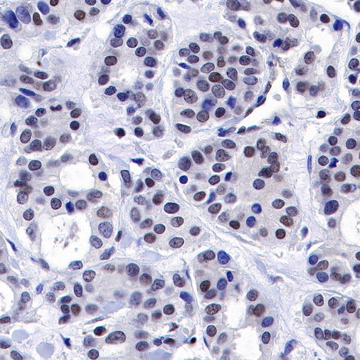 TFEB Recombinant Rabbit mAb (S-R296)