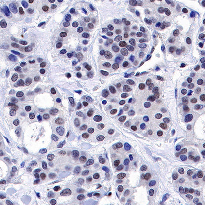 TFEB Recombinant Rabbit mAb (S-R296)
