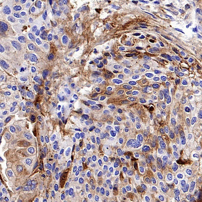 CD138 Recombinant Rabbit mAb (S-417-199)