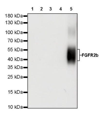FGFR2b Recombinant Rabbit mAb (SDT-423-18)