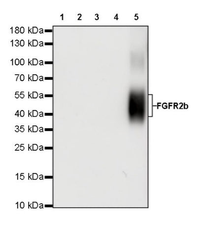 FGFR2b Recombinant Rabbit mAb (SDT-423-18)