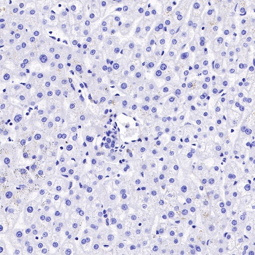 S-RMab® Pan Trk Recombinant Rabbit mAb (SDT-512-5)