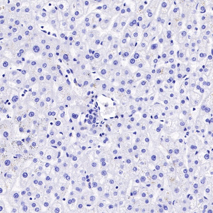 S-RMab® Pan Trk Recombinant Rabbit mAb (SDT-512-5)