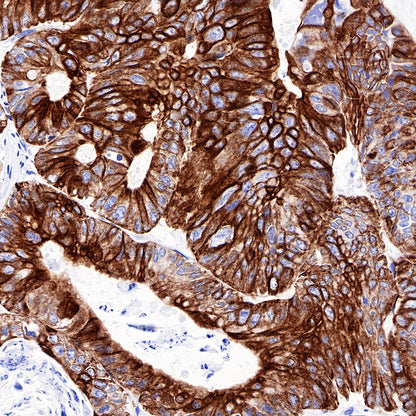 CK-LMW Recombinant Rabbit mAb (SDT-P003)