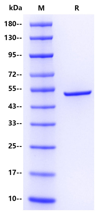 SARS-CoV-2 Nucleocapsid protein , His tag