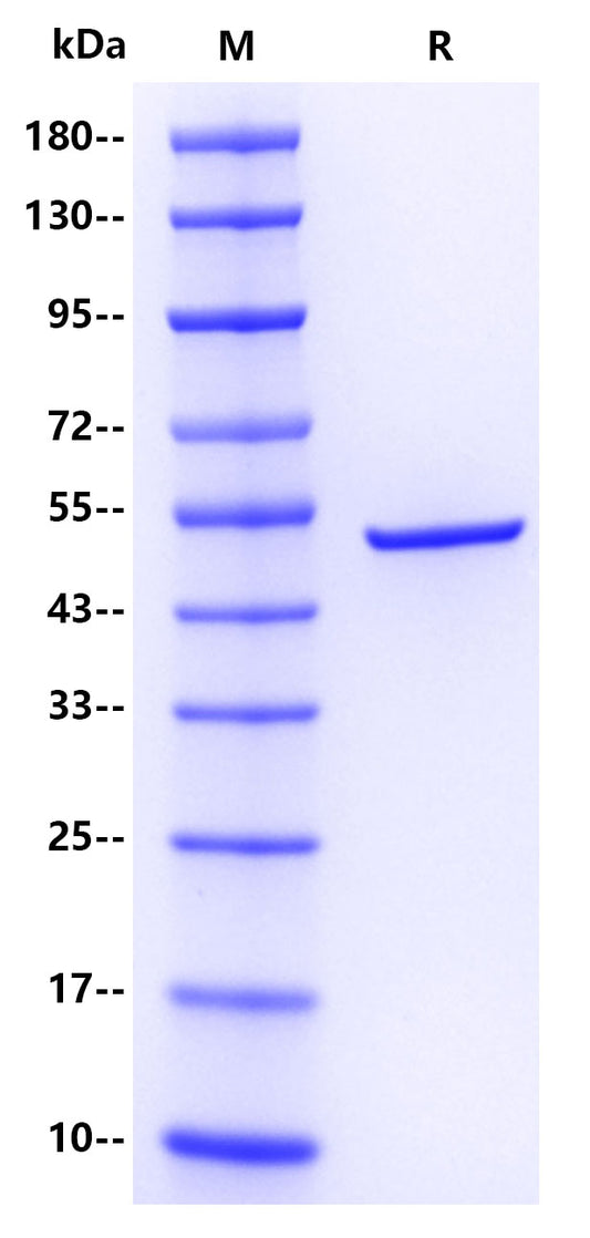 SARS-CoV-2 Nucleocapsid protein , His tag