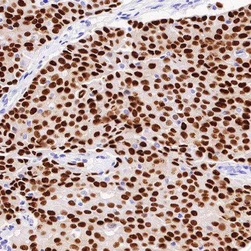 Estrogen Receptor α Recombinant Rabbit mAb (SDT-10001)