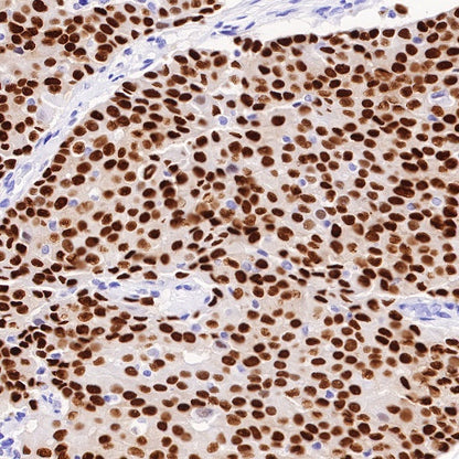 Estrogen Receptor α Recombinant Rabbit mAb (SDT-10001)