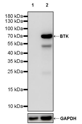 BTK Recombinant Rabbit mAb (SDT-2105-37)