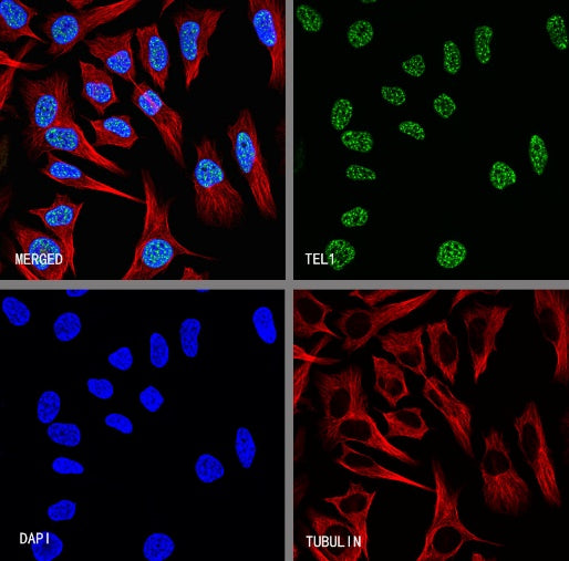 TEL1 Recombinant Rabbit mAb (S-3067-60)