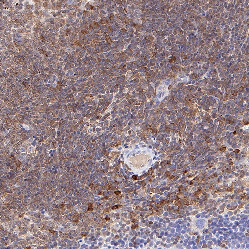 NF-κB p105/p50 Rabbit polyclonal antibody