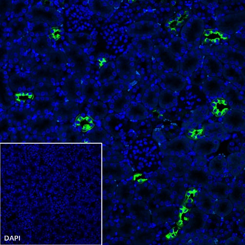 AQP2 Recombinant Rabbit mAb (SDT-2149-19)