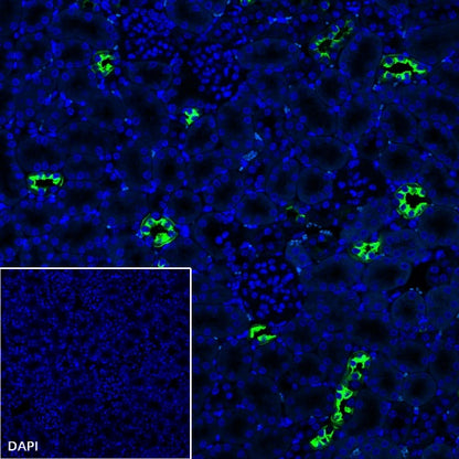 AQP2 Recombinant Rabbit mAb (SDT-2149-19)