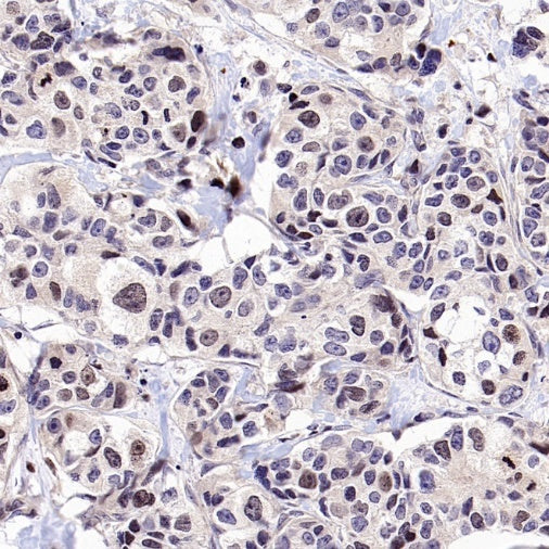 BRCA1 Recombinant Mouse mAb (S-4707)