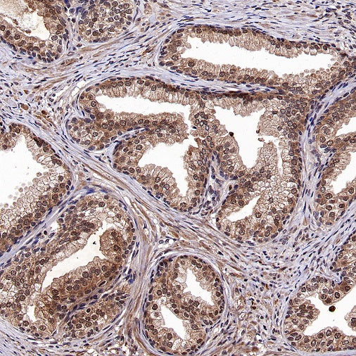 DNA Ligase IV/LIG4 Recombinant Rabbit mAb (S-2237-118)