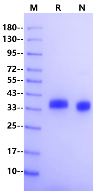 Spike RBD His Tag, SARS-CoV-2  (BA.4 /Omicron)