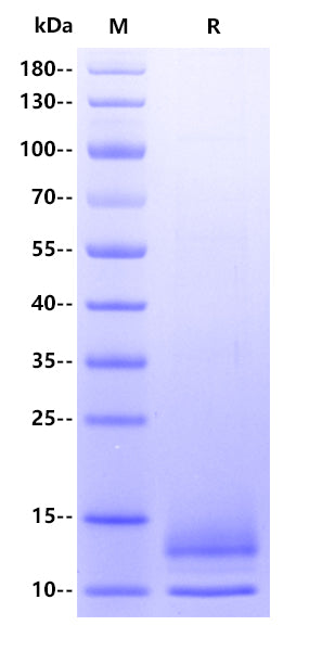 Human BCMA/TNFRSF17 Protein, His Tag