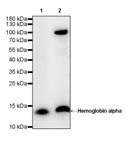 Hemoglobin alpha Recombinant Rabbit mAb (S-R242)