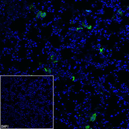 Thrombospondin 1 Recombinant Rabbit mAb (S-4153-22)