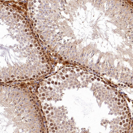 ACLY/ATP citrate lyase Recombinant Rabbit mAb (S-2025-32)