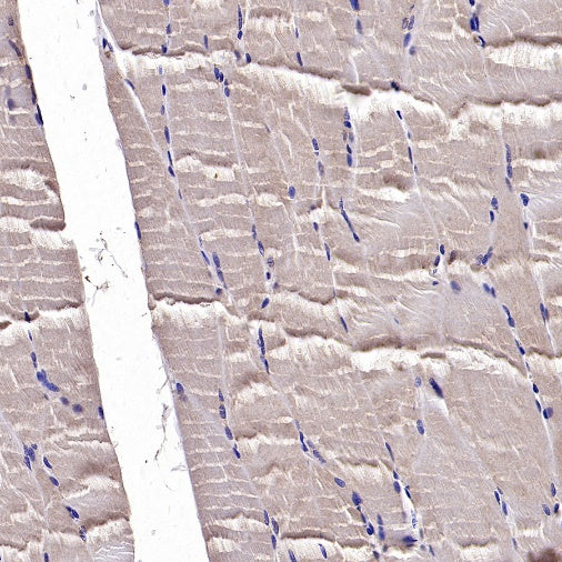 PTP1B Rabbit Polyclonal Antibody