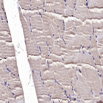 PTP1B Rabbit Polyclonal Antibody