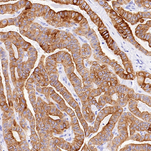 Jak1 Recombinant Rabbit mAb (S-4201)