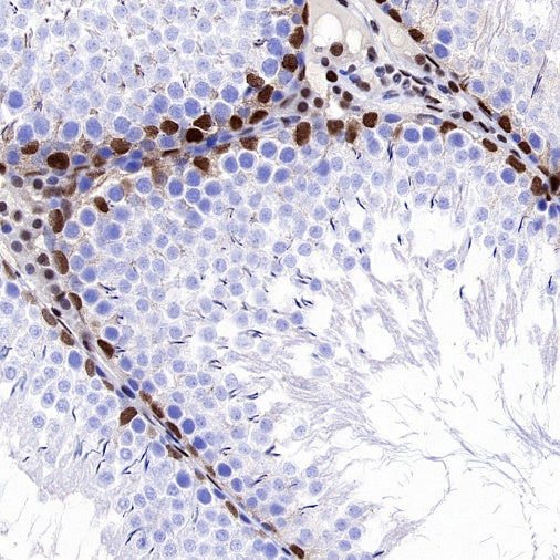 p27 Kip1 Recombinant Rabbit mAb (SDT-361-310)