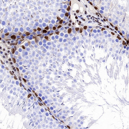 p27 Kip1 Recombinant Rabbit mAb (SDT-361-310)