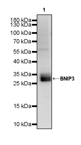BNIP3 Recombinant Rabbit mAb (S-2979-65)