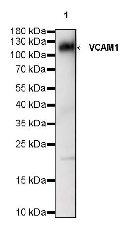 VCAM1 Recombinant Rabbit mAb (S-650-19)