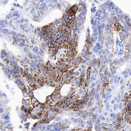 MAOA Rabbit Polyclonal Antibody