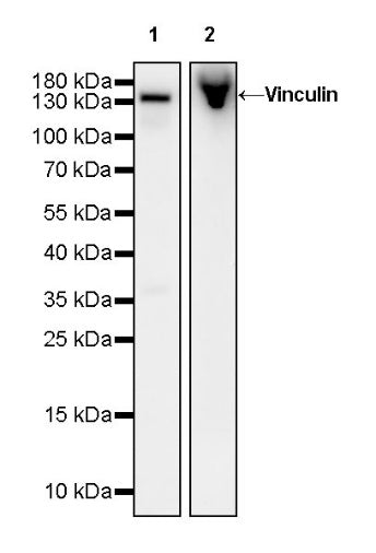 Vinculin Recombinant Rabbit mAb (S-1635-6)