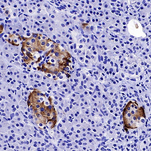 Somatostatin Receptor 2 Recombinant Rabbit mAb (SDT-2507-1)