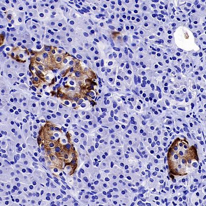 Somatostatin Receptor 2 Recombinant Rabbit mAb (SDT-2507-1)