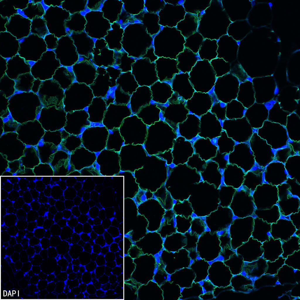 ATGL Recombinant Rabbit mAb (S-5284)