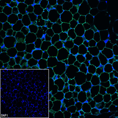 ATGL Recombinant Rabbit mAb (S-5284)