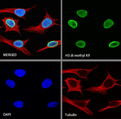 Histone H3 (di methyl K9) Recombinant Rabbit mAb (S-903-52)