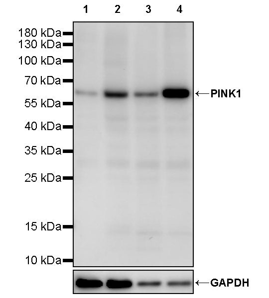 PINK1 Recombinant Rabbit mAb (S-3135-28)