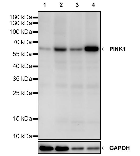 PINK1 Recombinant Rabbit mAb (S-3135-28)