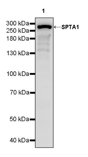 SPTA1 Recombinant Rabbit mAb (S-677-345)