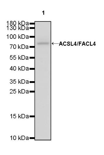 ACSL4/FACL4 Recombinant Rabbit mAb (S-461-6)