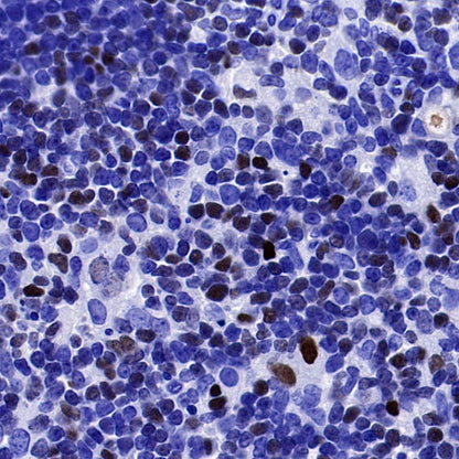 EGR2 Recombinant Rabbit mAb (S-741-136)