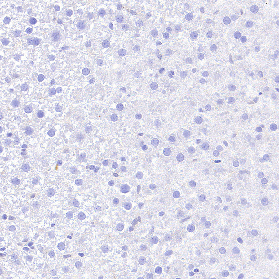 PITX2 Recombinant Rabbit mAb (S-4009-54)